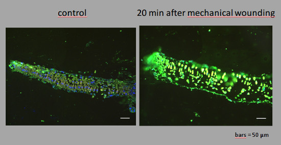 immunolocalization using anti-jasmonic acid antibodies